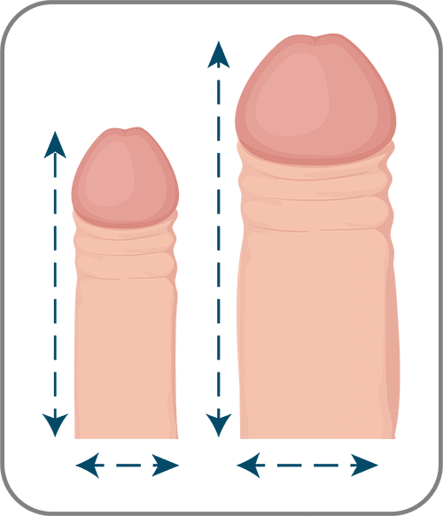 Penis enlargement surgery turkey