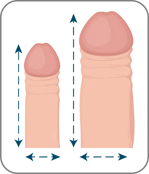 Penis enlargement surgery turkey