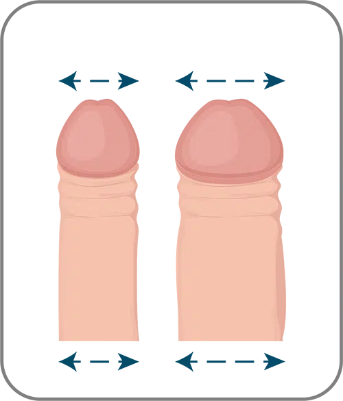 Penis enlargement surgery turkey